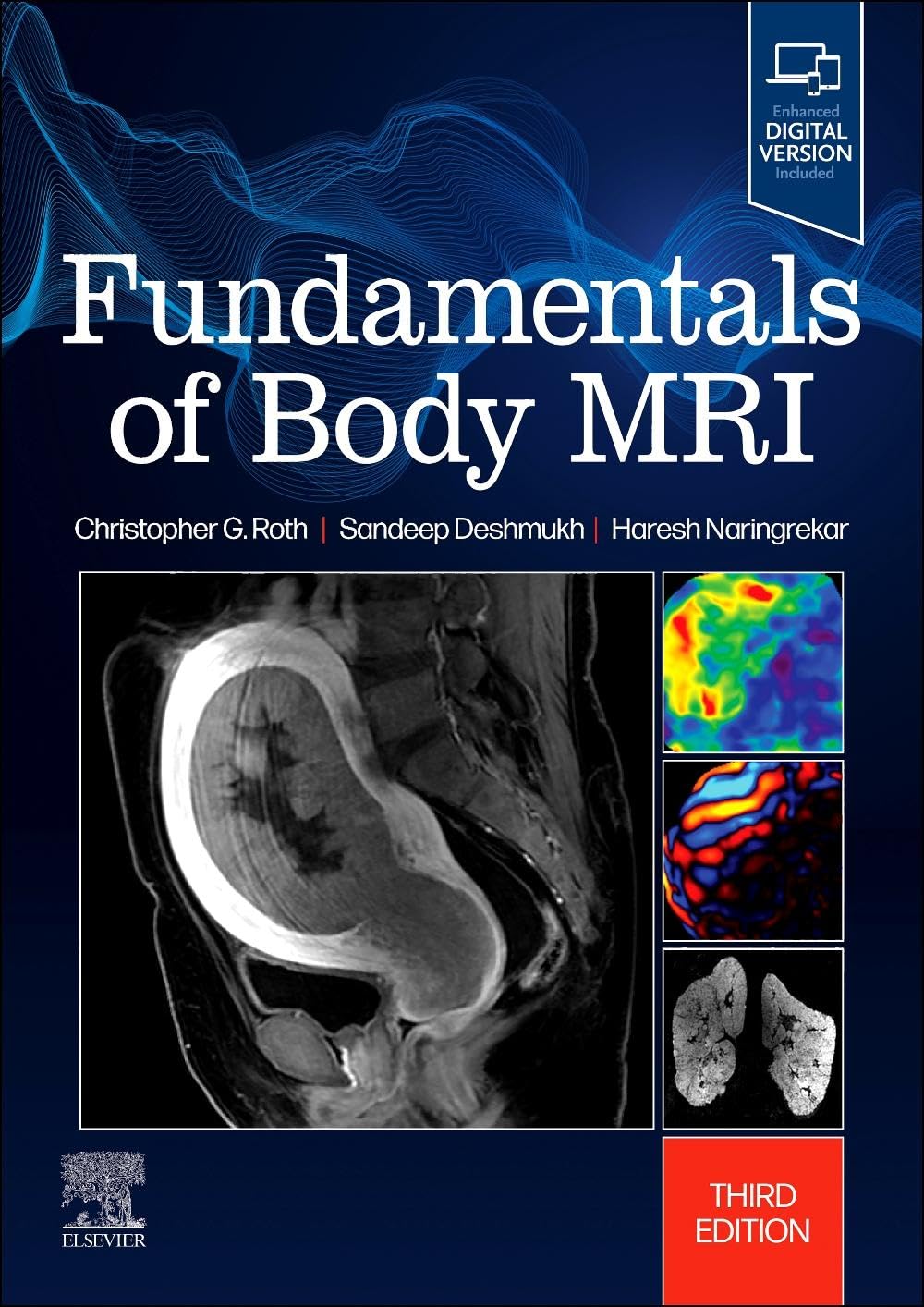 Fundamentals Of Body Mri With Access Code 3Ed (Pb 2025)