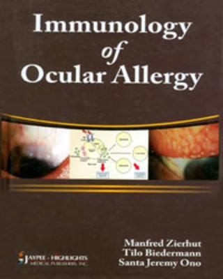 Immunology Of Ocular Allergy Edited By Manfred Zierhut Tilo Biedermann Santa Jeremy Ono