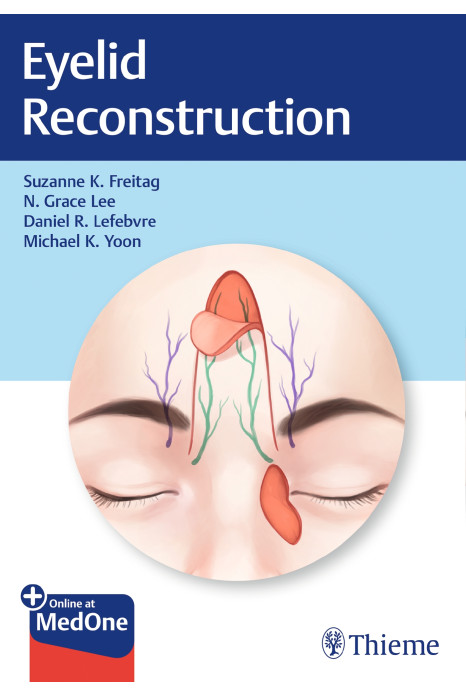 Eyelid Reconstruction 1st Edition 2020