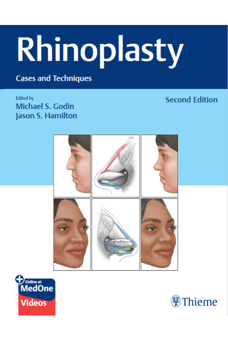 Rhinoplasty Cases And Techniques