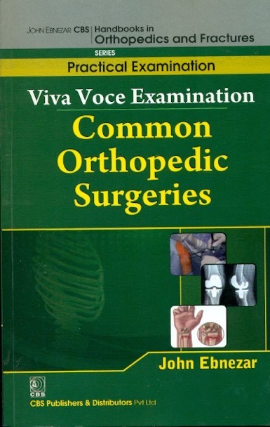 Viva Voce Examination Common Orthopedic Surgeries (Handbooks In Orthopedics And Fractures Series Vol 69 Practical Examination (2012)