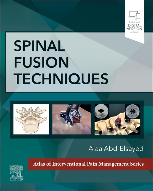 Spinal fusion techniques with access code (hb 2024)