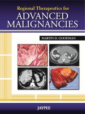Regional Therapeutics For Advanced Malignancies