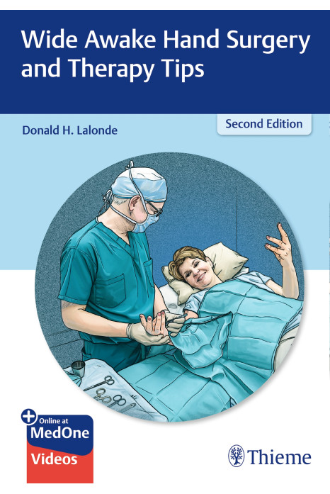 Wide Awake Hand Surgery And Therapy Tips
