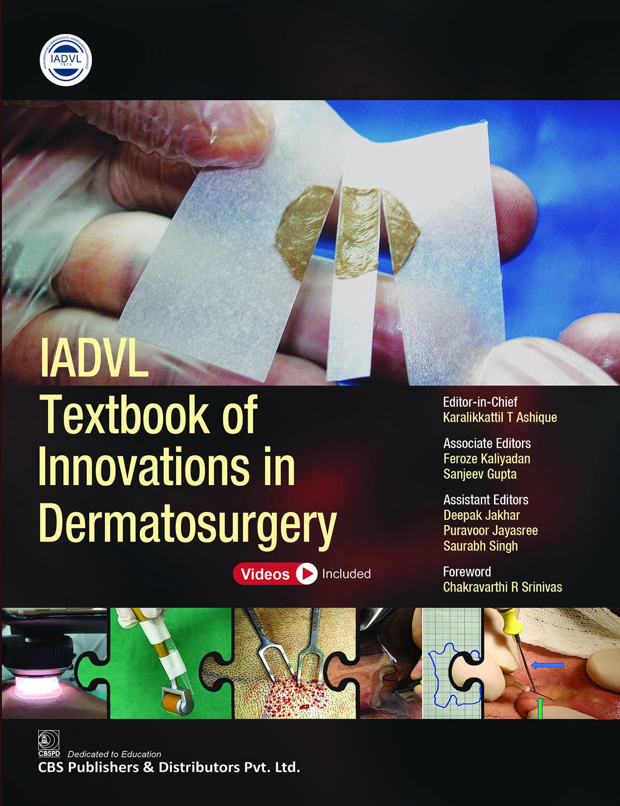 Iadvl Textbook Of Innovations In Dermatosurgery 1ST EDITION 2022