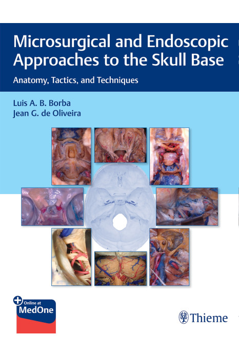 Microsurgical and Endoscopic Approaches to the Skull Base 1st Edition 2021
