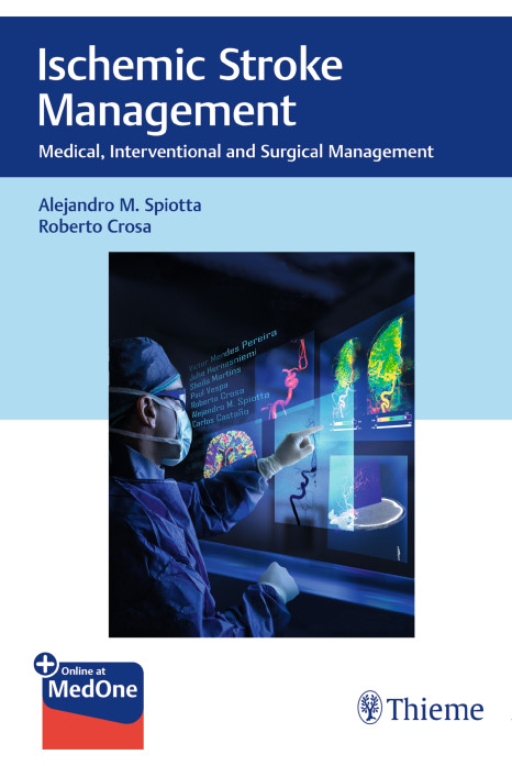Ischemic Stroke Management 1st Edition 2019