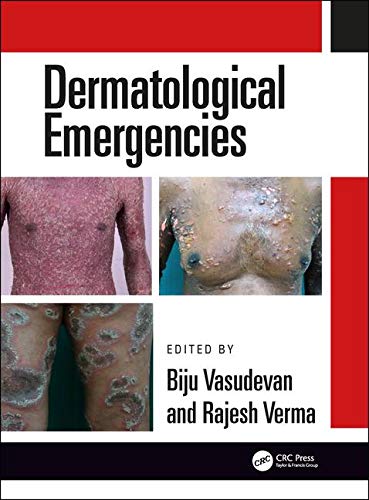 Dermatological Emergencies (Hb 2019)