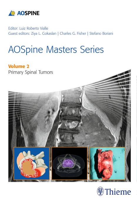Aospine Masters Series Volume 2 Primary Spinal Tumors