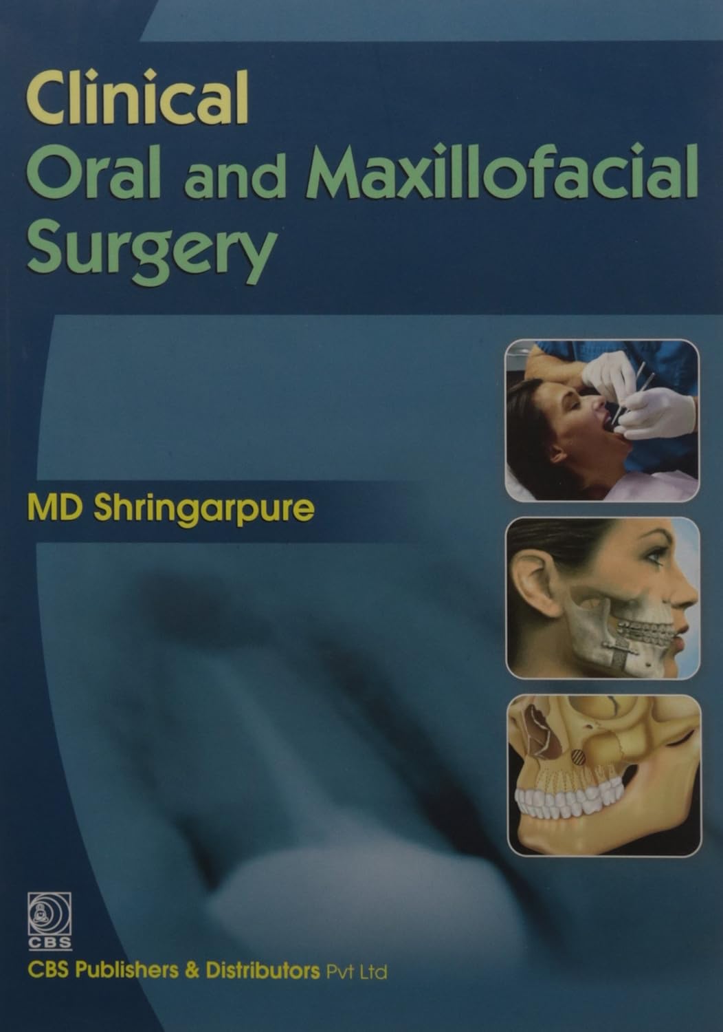 Clinical Oral And Maxillofacial Surgery (Pb 2012)