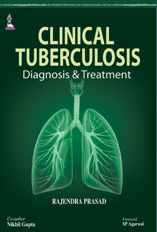 Clinical Tuberculosis Diagnosis & Treatment