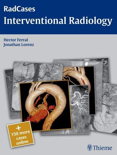 Interventional Radiology