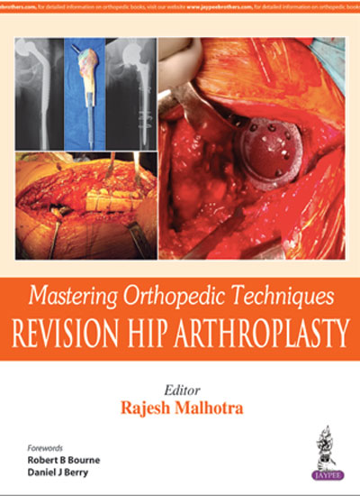 MASTERING ORTHOPEDIC TECHNIQUES REVISION HIP ARTHROPLASTY