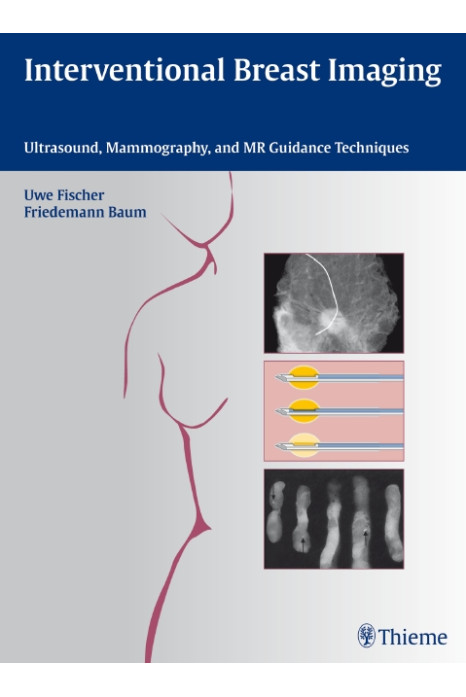 Interventional Breast Imaging (Hb 2010)