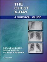 The Chest X-Ray A Survival Guide