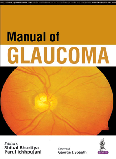 Manual Of Glaucoma