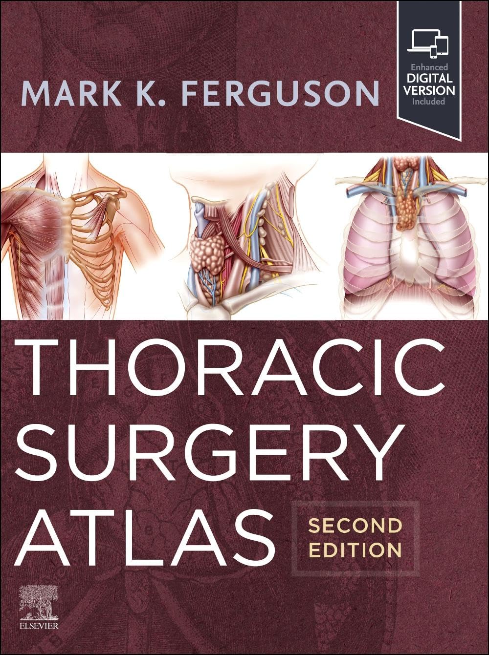 Thoracic surgery atlas with access code 2ed (hb 2024)