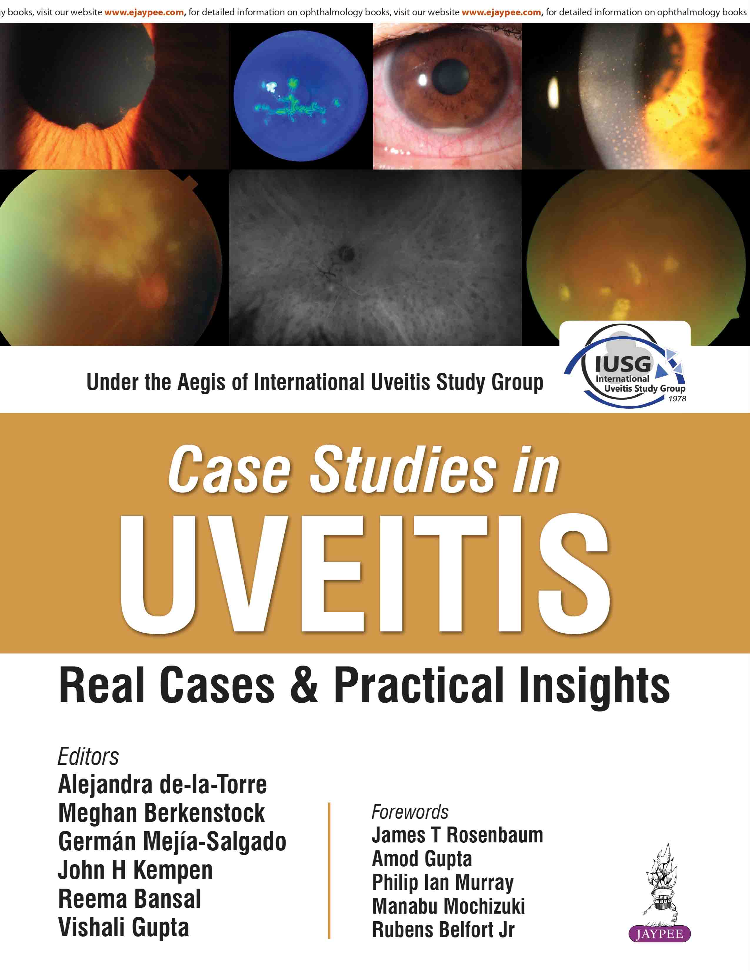 CASE STUDIES IN UVEITIS : REAL CASES AND PRACTICAL INSIGHTS