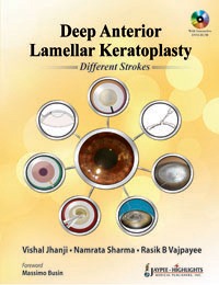 Deep Anterior Lamellar Keratoplasty Different Strokes With Dvd Rom