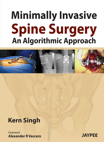 Minimally Invasive Spine Surgery An Algorithmic Approach