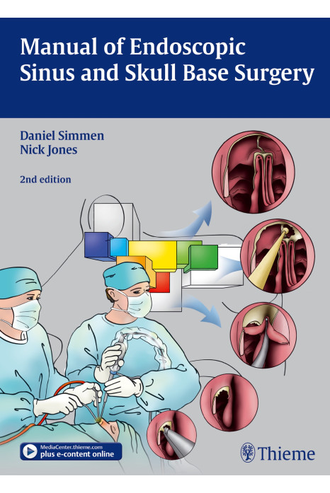 Manual Of Endoscopic Sinus And Skull Base Surgery