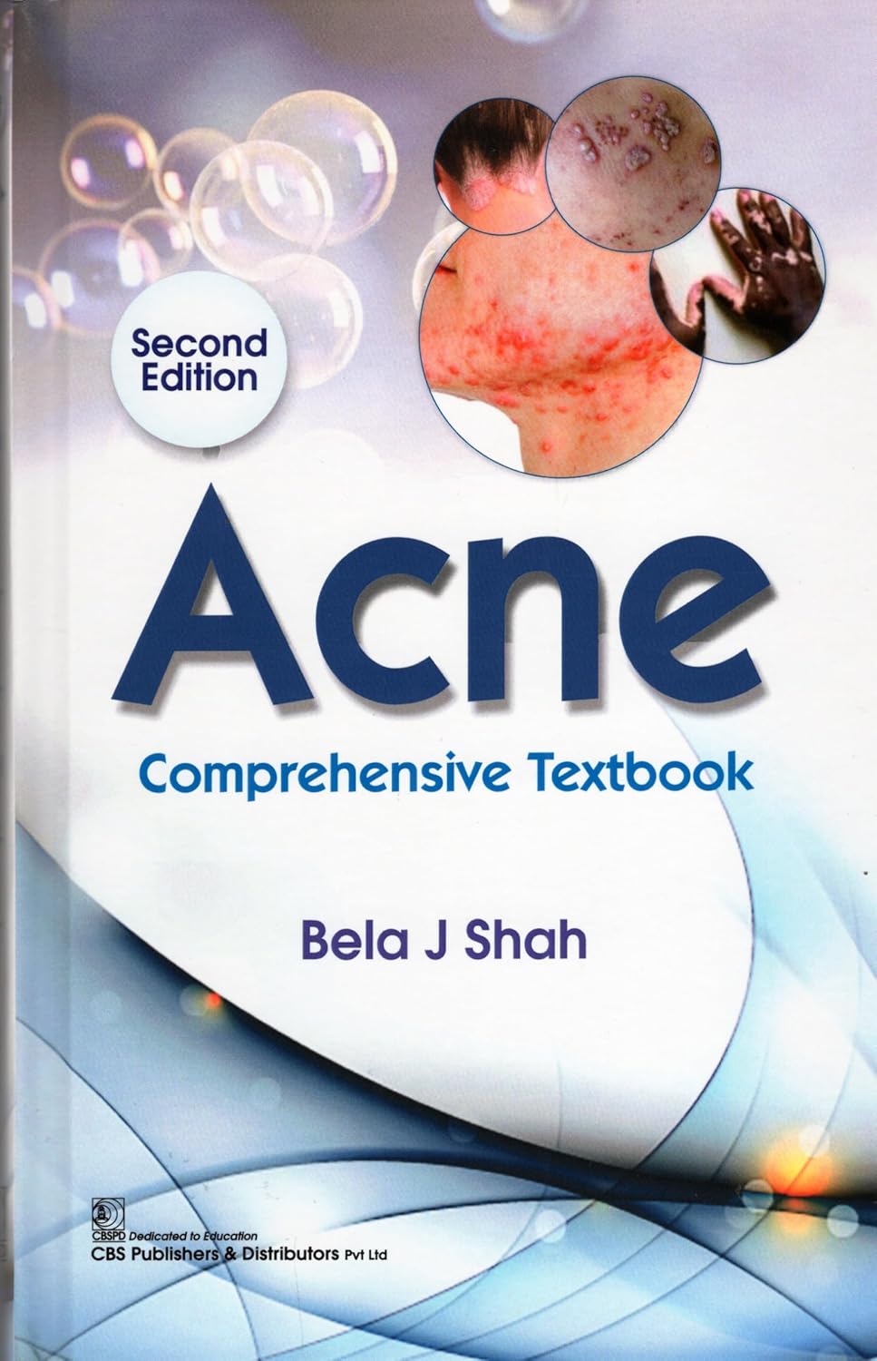 Acne Atlas With Treatment Options 2Ed (Hb 2025)