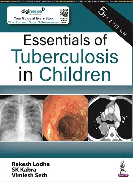 ESSENTIALS OF TUBERCULOSIS IN CHILDREN 5TH EDITION 2023