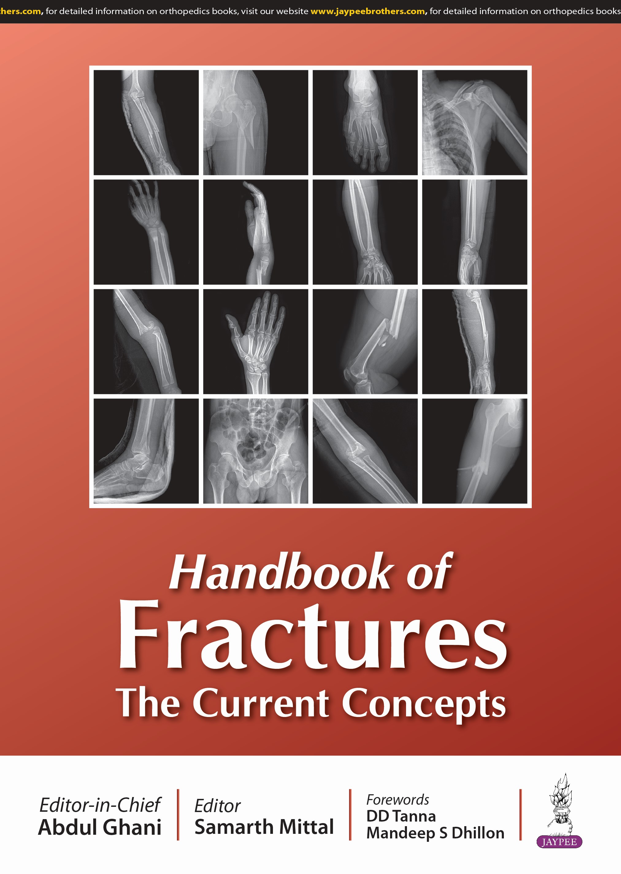 HANDBOOK OF FRACTURES THE CURRENT CONCEPTS