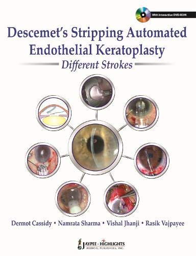 DESCEMET'S STRIPPING AUTOMATED ENDOTHELIAL KERATOPLASTY:DIFFERENT STROKES
