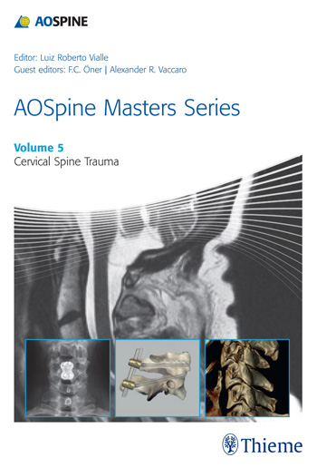 Spinal Deformities The Comprehensive Text