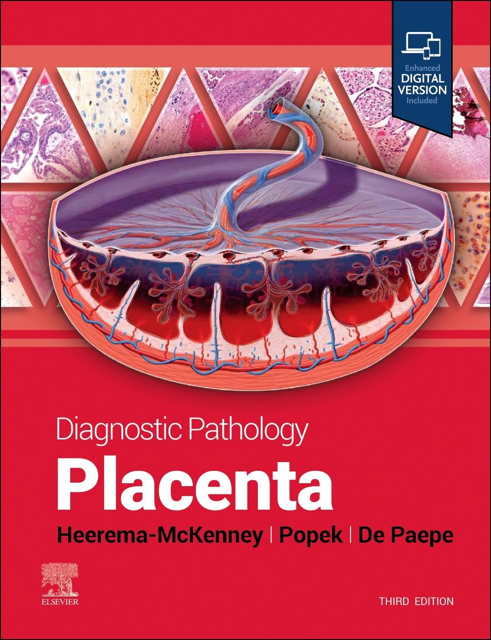Diagnostic pathology placenta with access code 3ed (hb 2025)