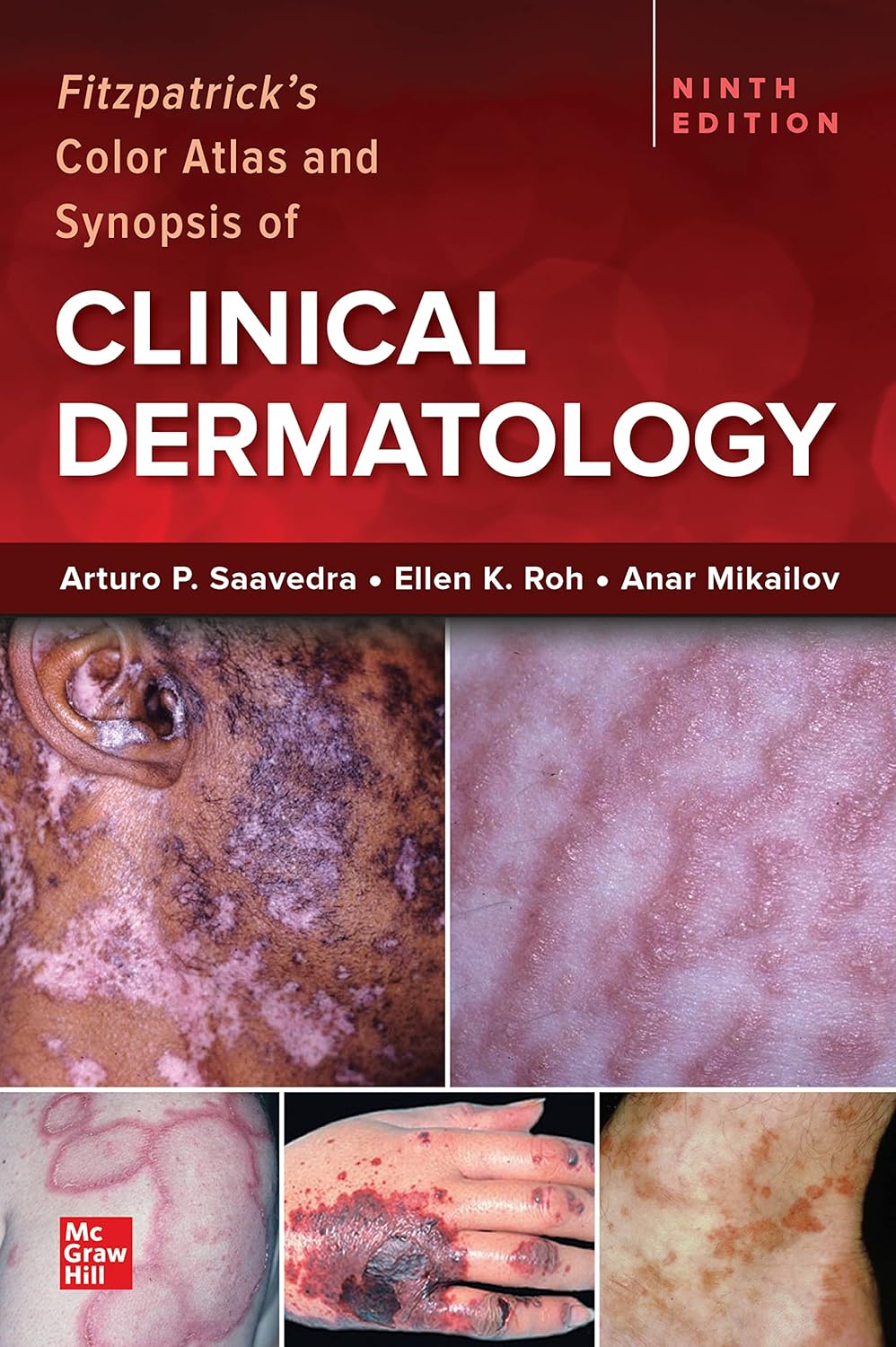 Fitzpatricks Color Atlas And Synopsis Of Clinical Dermatology 9Ed (Ie) (Pb 2023)
