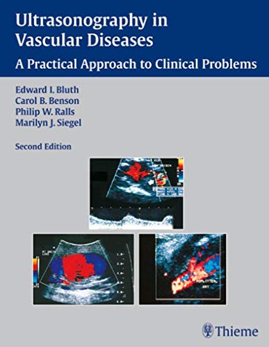 Ultrasonography in Vascular Diseases 2nd Edition 2008