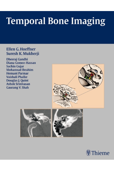 Temporal Bone Imaging