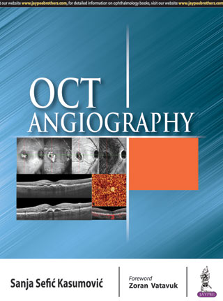 OCT ANGIOGRAPHY