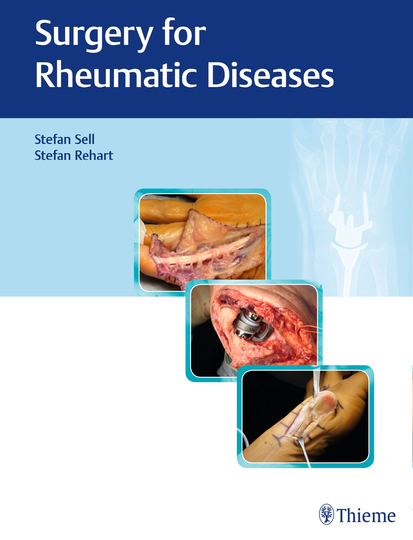 Surgery For Rheumatic Diseases (Hb 2018)