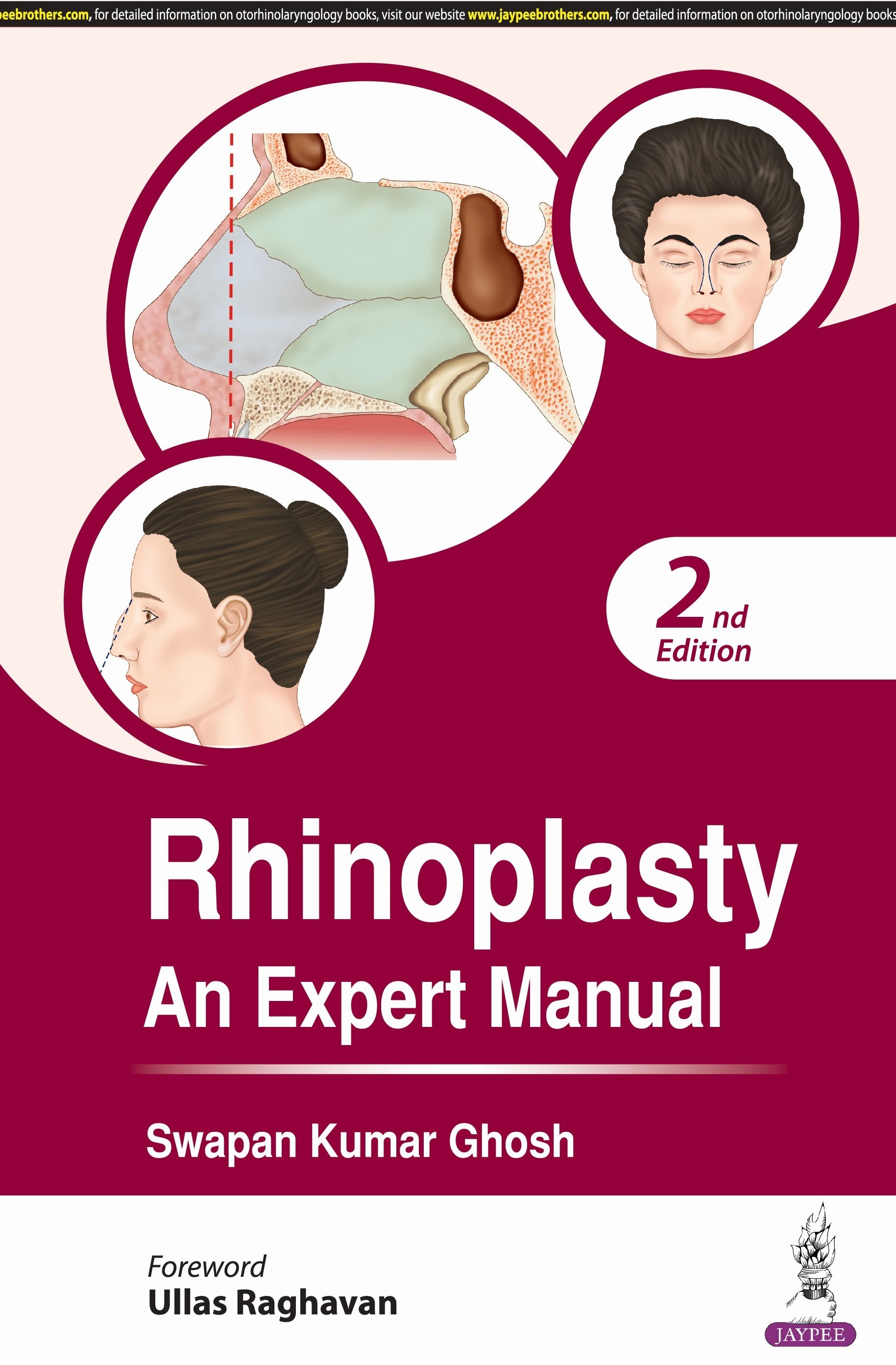 Rhinoplasty An Expert Manual