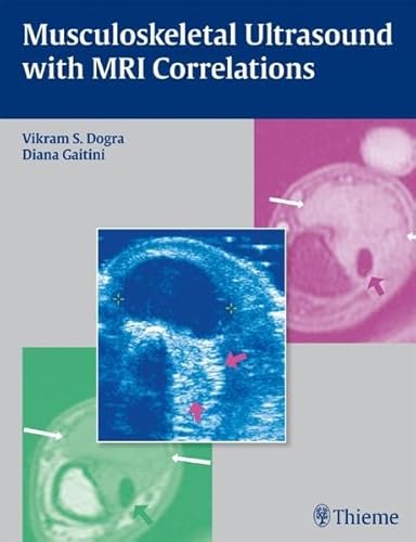 Musculoskeletal Ultrasound With MRI Correlations