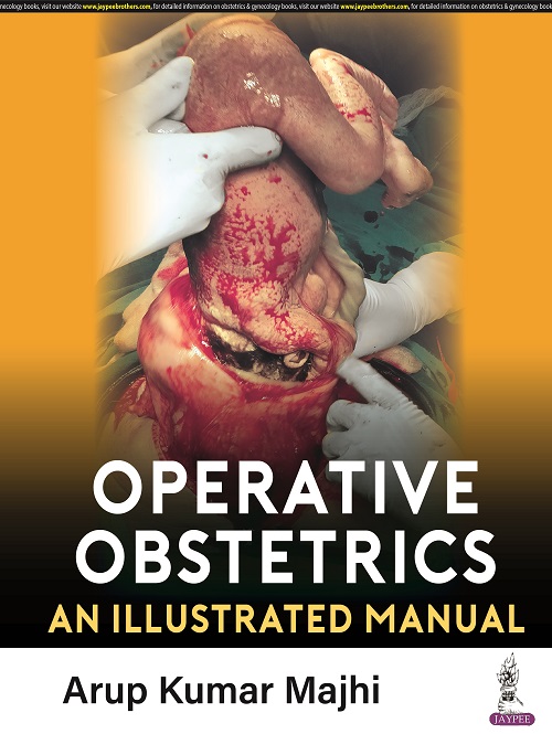 OPERATIVE OBSTETRICS: AN ILLUSTRATED MANUAL 1ST EDITION 2023