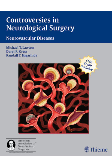 Controversies In Neurological Surgery Neurovascular Diseases