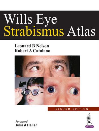 Wills Eye Strabismus Atlas