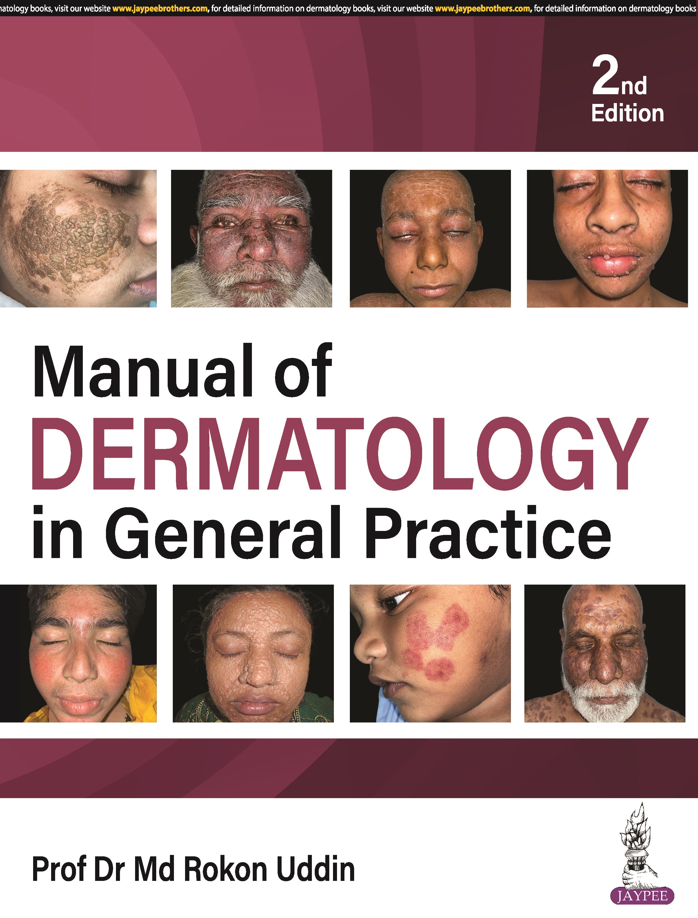 MANUAL OF DERMATOLOGY IN GENERAL PRACTICE