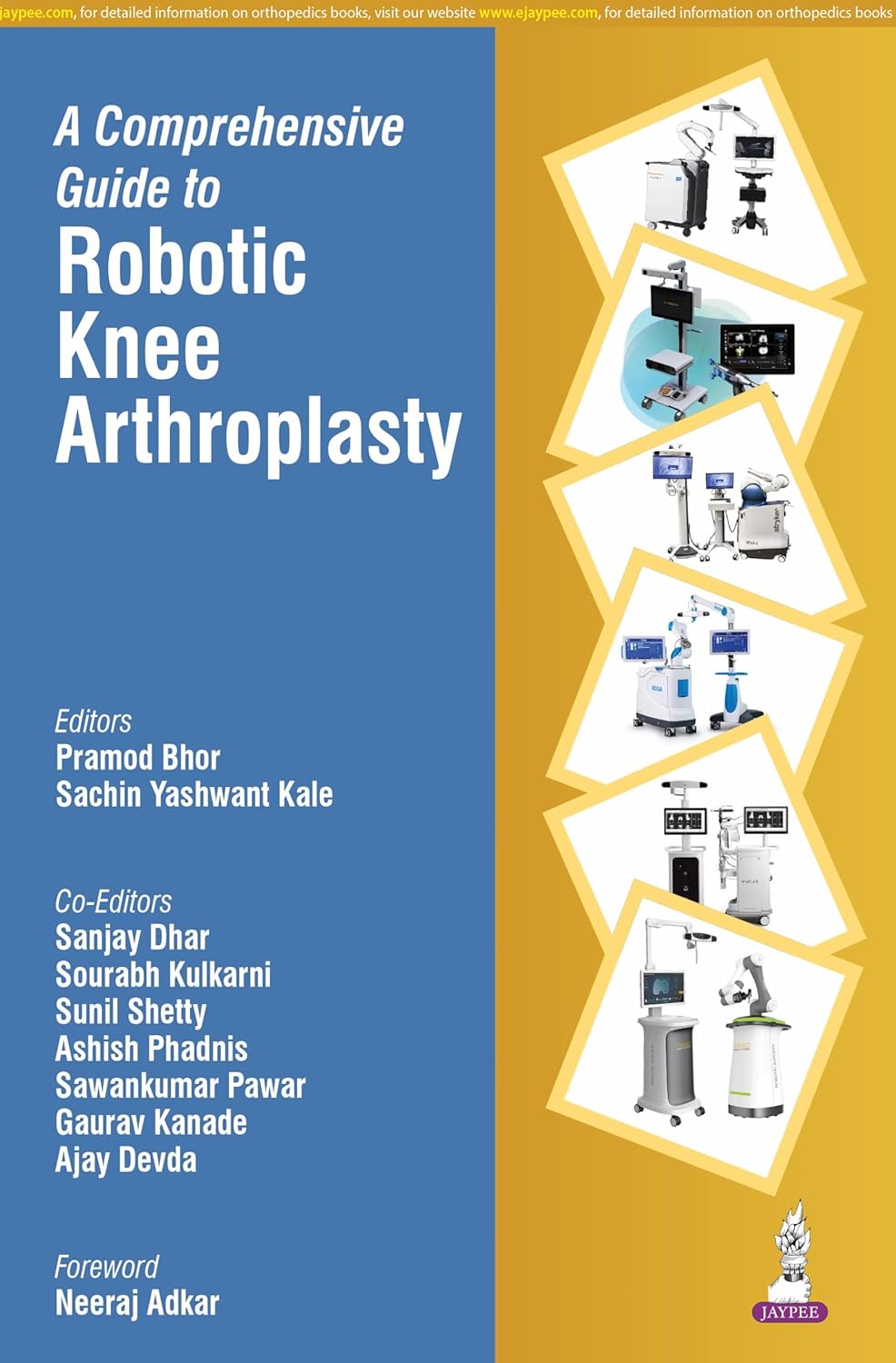 A Comprehensive Guide To Robotic Knee Arthroplasty
