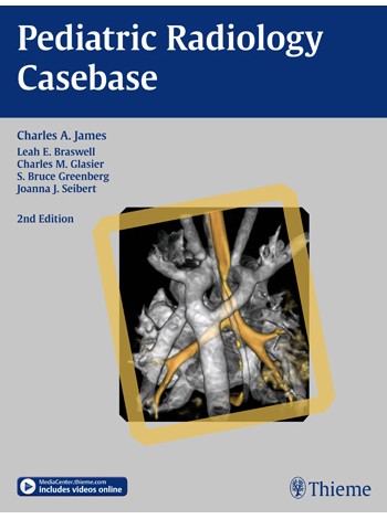 Lippincott's Illustrated Reviews Biochemistry 1st SAE/2020