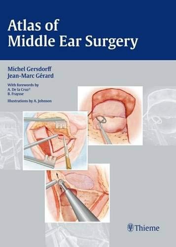 Surgery of the Middle Ear
