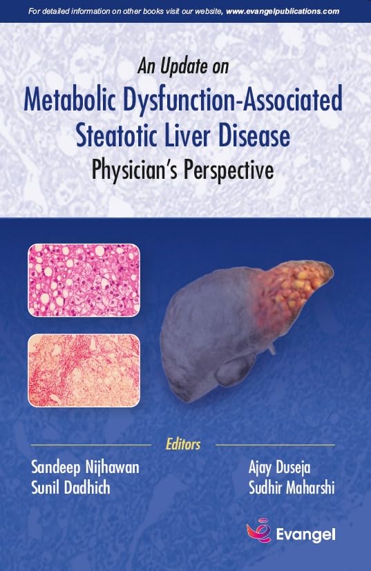 An Update on Metabolic Dysfunction-Associated Steatotic Liver Disease Physician’s Perspective