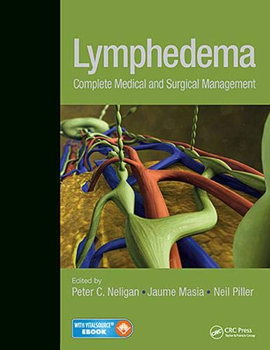 Lymphedema: Complete Medical and Surgical Management: 1/e