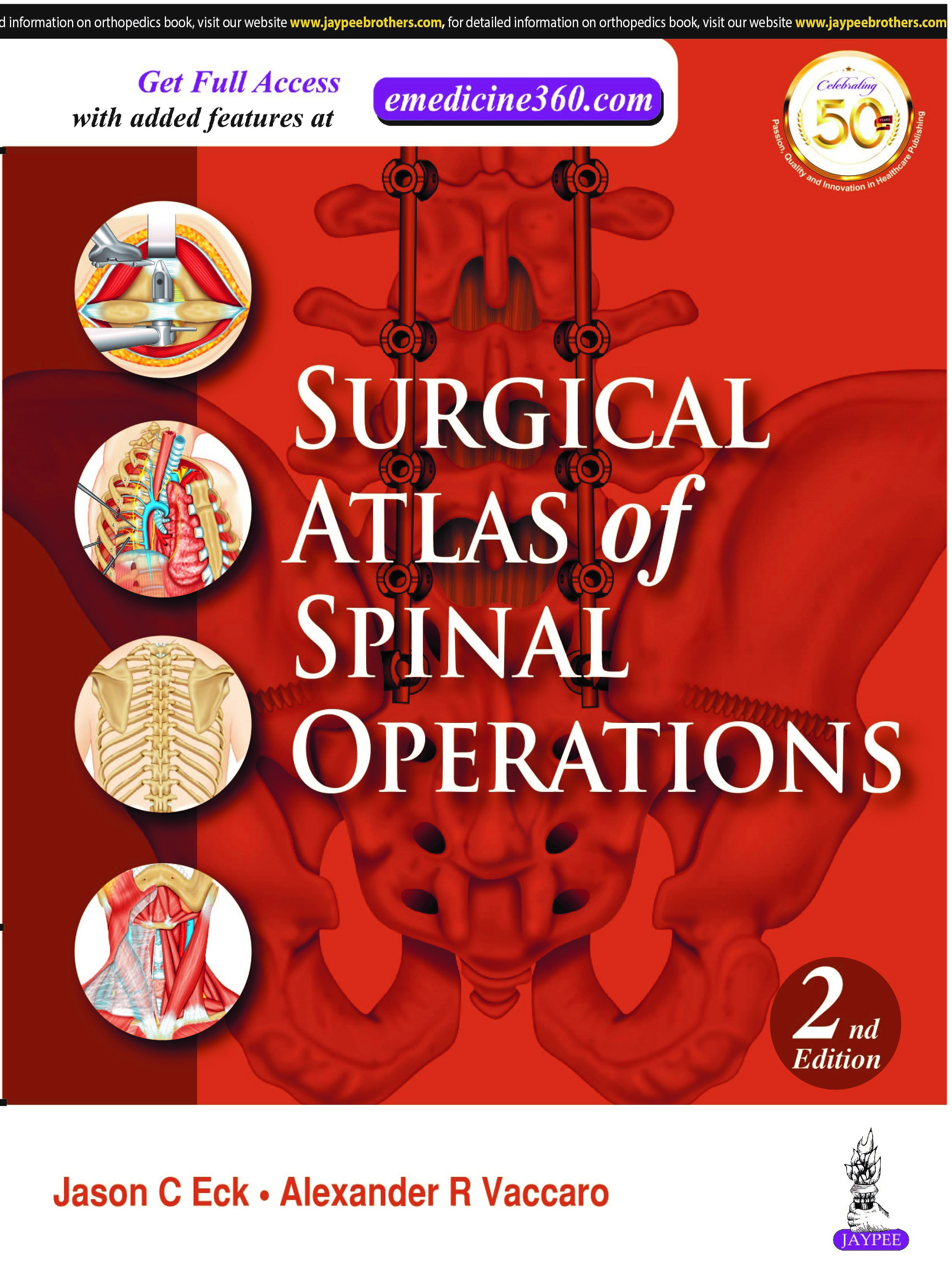 Surgical Atlas Of Spinal Operations
