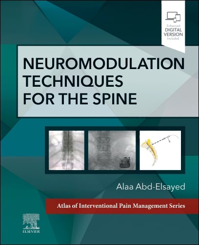 Neuromodulation techniques for the spine (hb 2024)