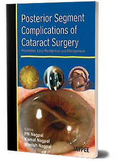 POSTERIOR SEGMENT COMPLICATIONS OF CATARACT SURGERY PREV.,EARLY RECOG.AND MANAGEMENT